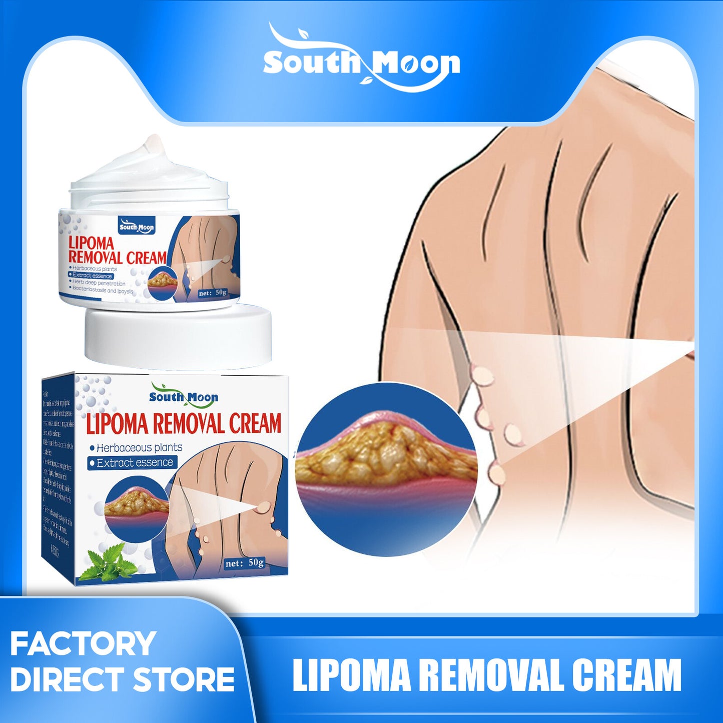South Moon Lipoma Removal Cream