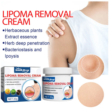 South Moon Lipoma Removal Cream